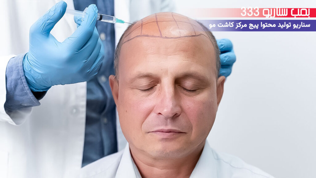 33 ایده تولید محتوا برای پیج مرکز کاشت مو در اینستاگرام